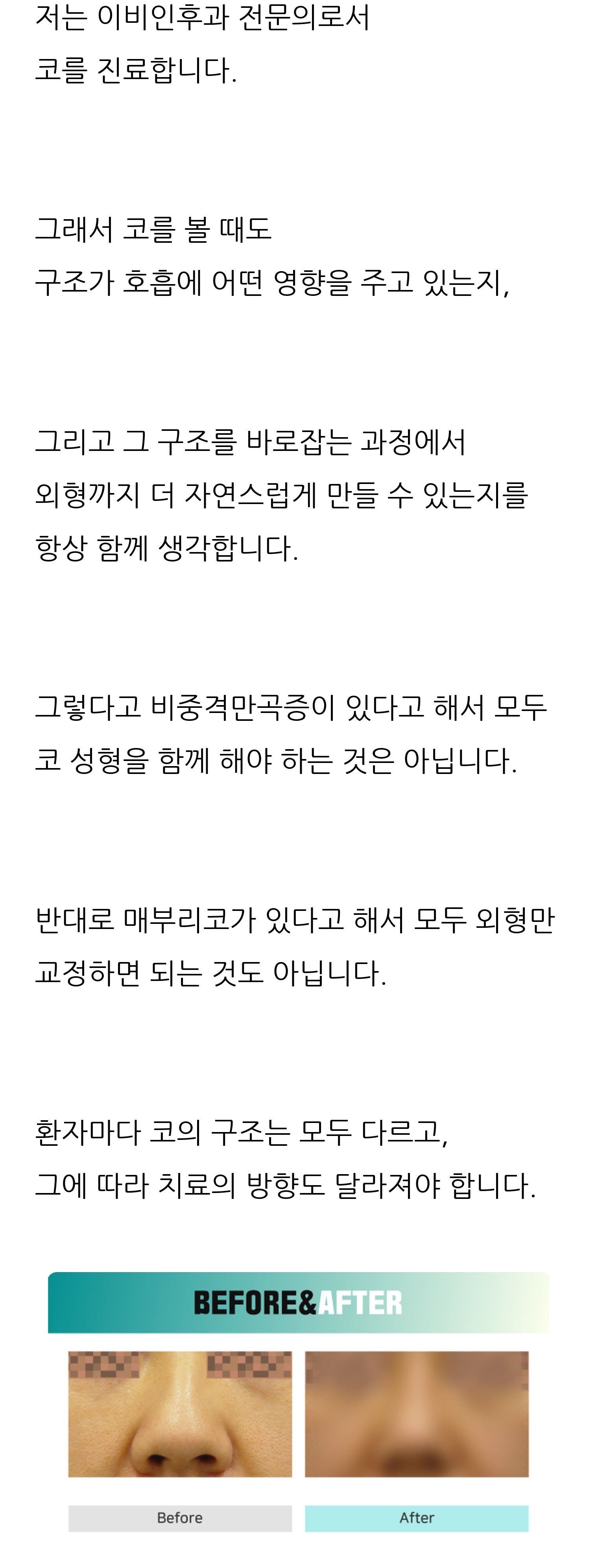 청주 두리이비인후과 비중격만곡증·매부리코 안내 12