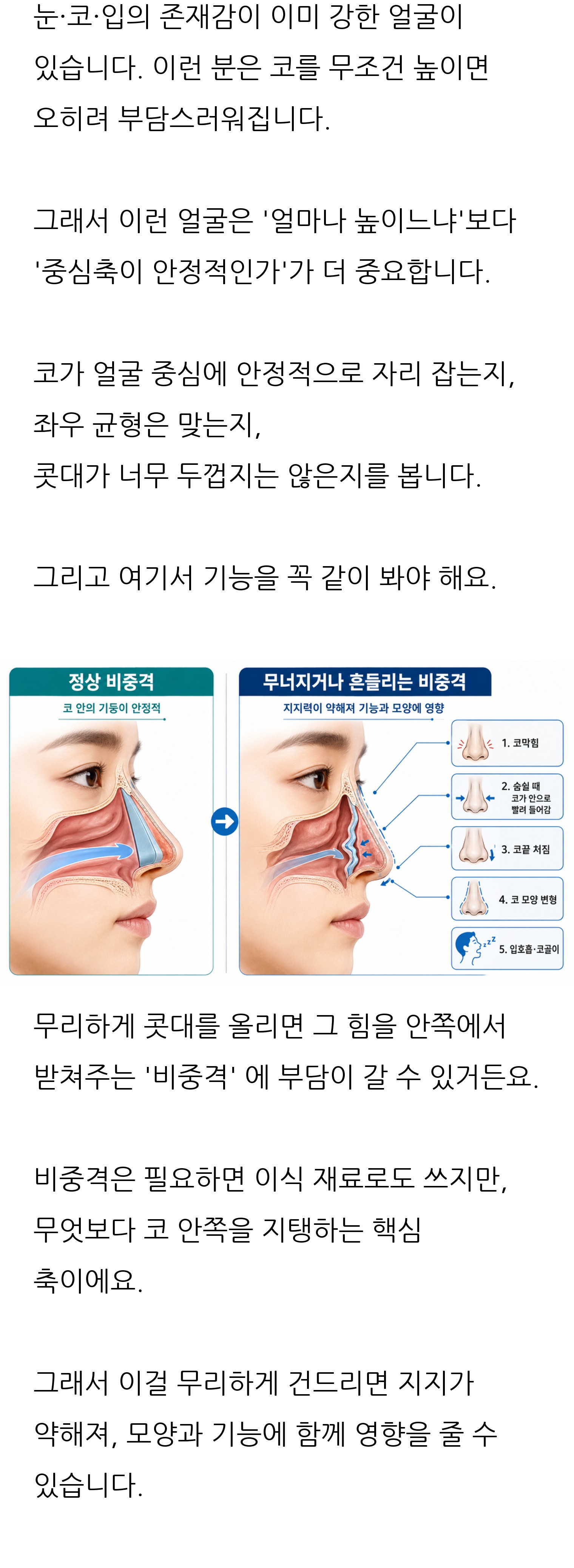 청주 두리이비인후과 비중격만곡증·매부리코 안내 6